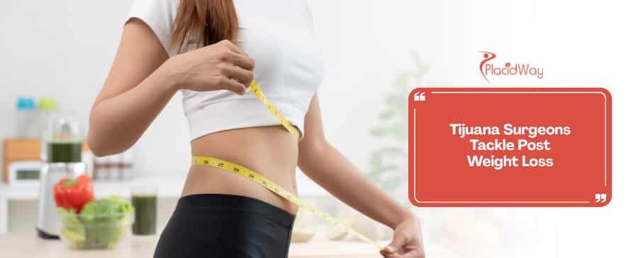 The Circumferential Lift: How Tijuana Surgeons are Addressing the 2026 GLP-1 Weight Loss Boom