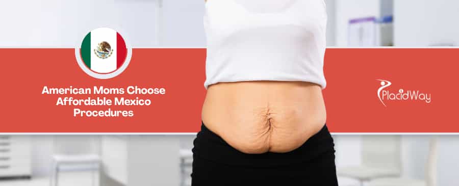 Tummy Tuck in Mexico vs USA - How American Moms Are Avoiding $12,000 Surgical Bills