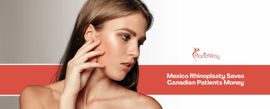 Rhinoplasty in Mexico vs Canada - Escaping High Aesthetic Surgery Costs in Toronto and Vancouver