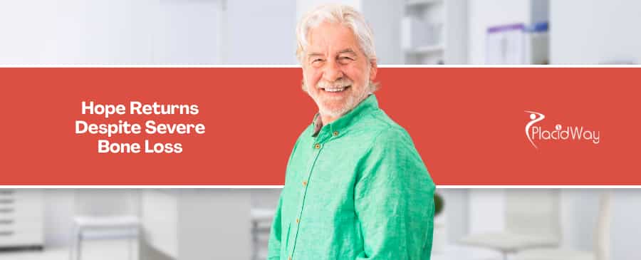 Zygomatic Implants in Mexico vs USA - How Seniors with Bone Loss Afford Advanced Surgeries Denied by Medicare