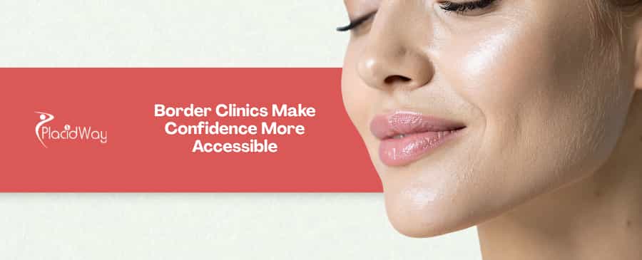 5 Surprising Facts About Chin Liposuction Costs in Mexican Border Towns for US Adults