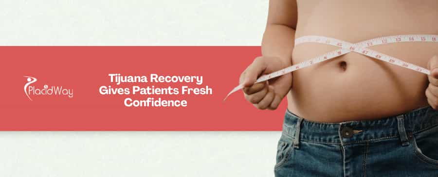 7 Reasons US Patients Choose Single-Incision Gastric Sleeve in Tijuana for Faster Recovery
