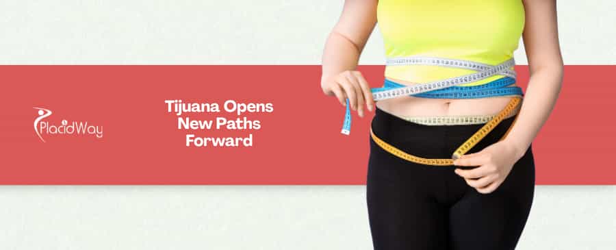 5 Reasons the SADI-S Procedure in Tijuana is the Best Choice for High BMI US Patients
