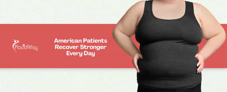 8 Recovery Tips for American Patients Undergoing Duodenal Switch in Piedras Negras