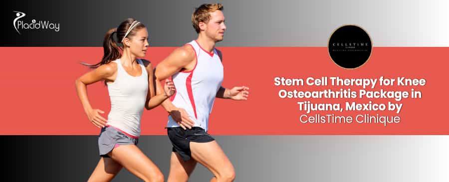 Stem Cell Therapy for Knee Osteoarthritis in Tijuana Mexico at CellsTime