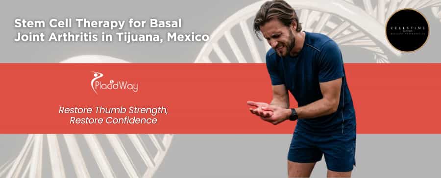 Stem Cell Therapy for Basal Joint Arthritis in Tijuana at CellsTime Clinique