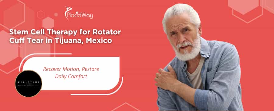 Stem Cell Therapy for Rotator Cuff Tear in Tijuana at CellsTime Clinique