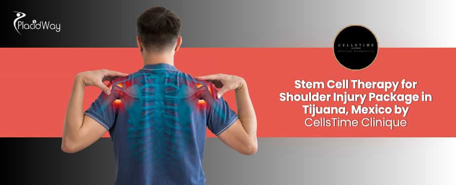 Stem Cell Therapy for Shoulder Injury in Tijuana at CellsTime Clinique
