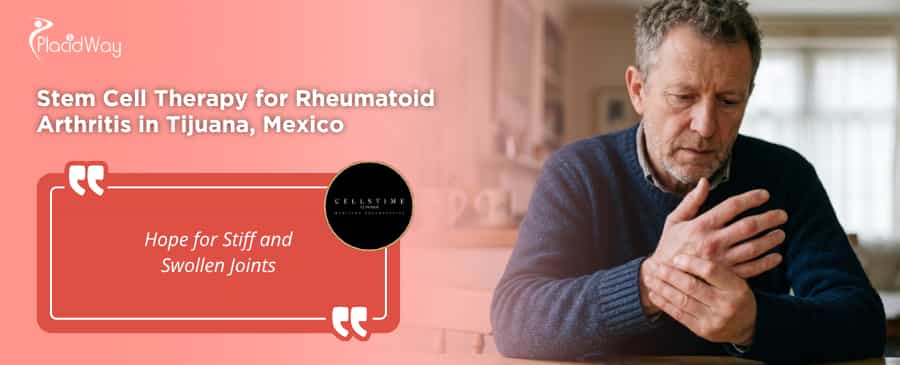 Stem Cell Therapy for Rheumatoid Arthritis in Tijuana at CellsTime Clinique