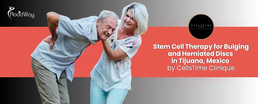 Stem Cell Therapy for Bulging and Herniated Discs in Tijuana at CellsTime Clinique