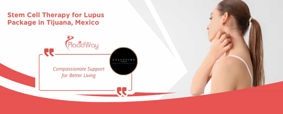 Stem Cell Therapy for Lupus in Tijuana at CellsTime Clinique