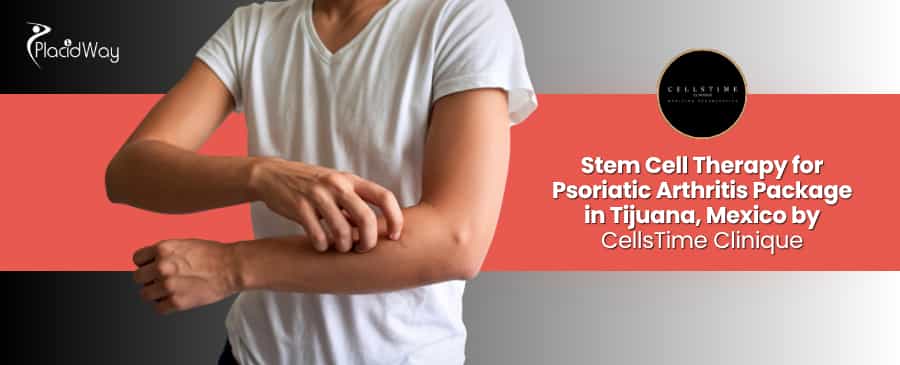 Stem Cell Therapy for Psoriatic Arthritis in Tijuana at CellsTime Clinique