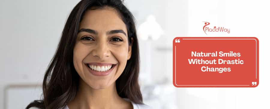 No-Prep Veneers in Escazú, Costa Rica: 2026 Guide