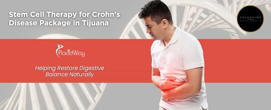 Stem Cell Therapy for Crohn’s Disease in Tijuana at CellsTime Clinique