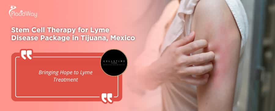 Stem Cell Therapy for Lyme Disease in Tijuana at CellsTime Clinique