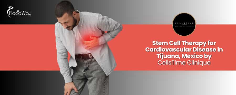 Stem Cell Therapy for Cardiovascular Disease in Tijuana at CellsTime Clinique