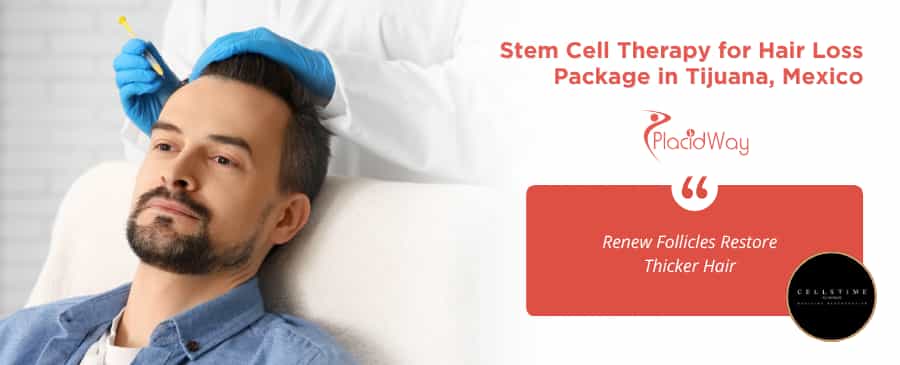 Stem Cell Therapy for Hair Loss in Tijuana at CellsTime Clinique