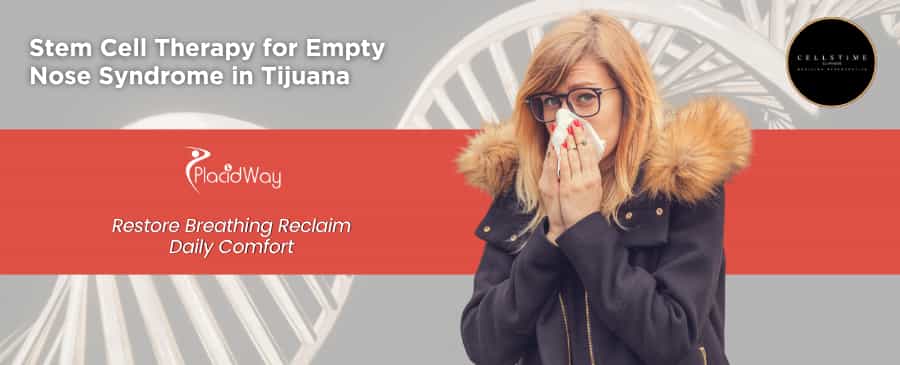 Stem Cell Therapy for Empty Nose Syndrome Package in Tijuana, Mexico by CellsTime Clinique