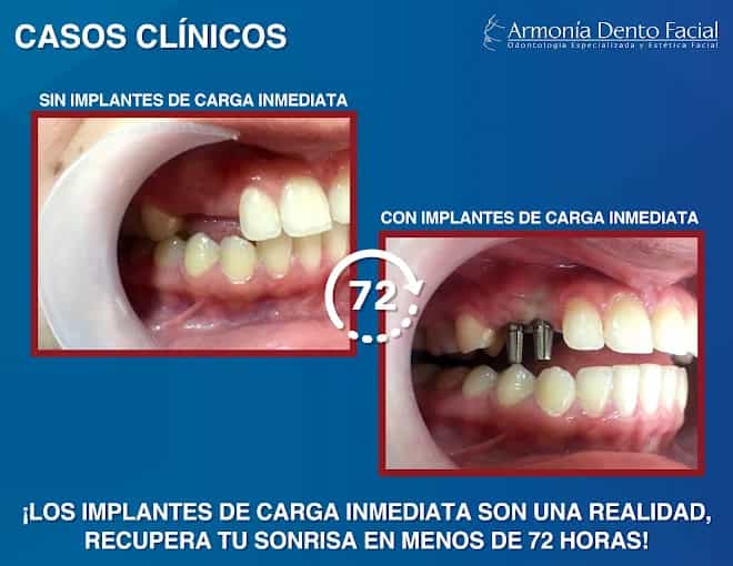 Dental Clinic in Bogota Colombia Review