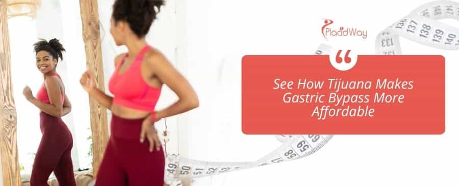 gastric bypass in Tijuana, Mexico