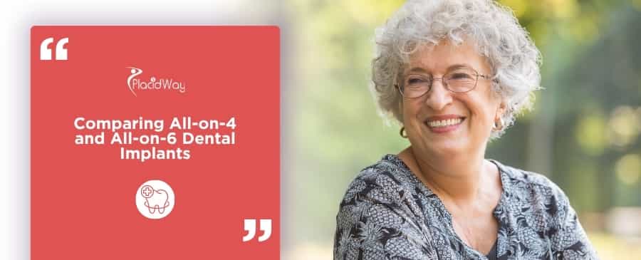 All-on-4 vs All-on-6 Dental Implants in Los Algodones for American Patients: US Cost Guide