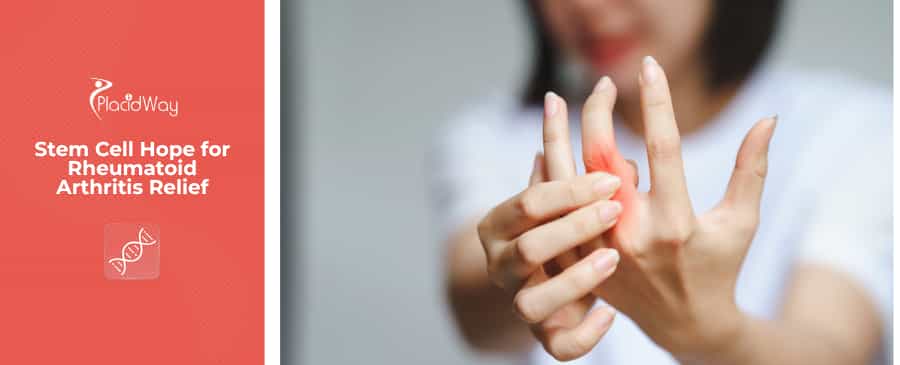 women suffers rheumatoid arthritis