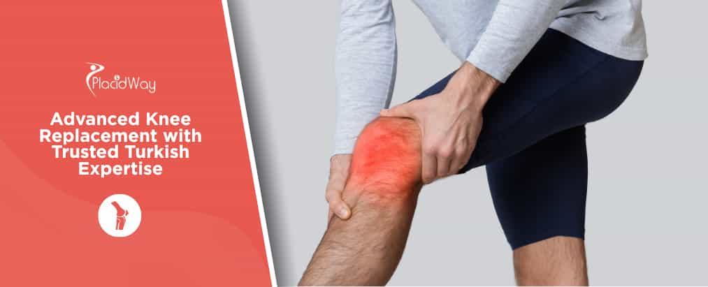 Total Knee Replacement in Turkey