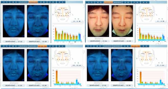 Anti-Aging Stem Cell Treatment in Japan