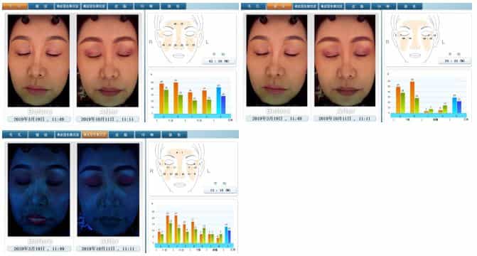 Facial Rejuvenation Therapy in Tokyo