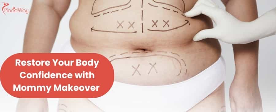 Mommy Makeover in Mexico