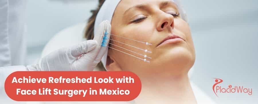 Facelift in Mexico