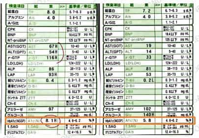 Autologous Stem Cells for Diabetes Case 1 Results