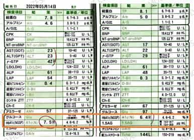 Stem Cell Treatment in Japan for Diabetes Case 2 Results