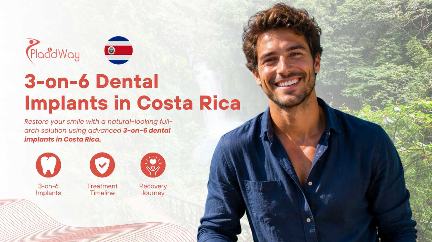 3-on-6 Dental Implants in Costa Rica: Costs, Safety and Travel Guide