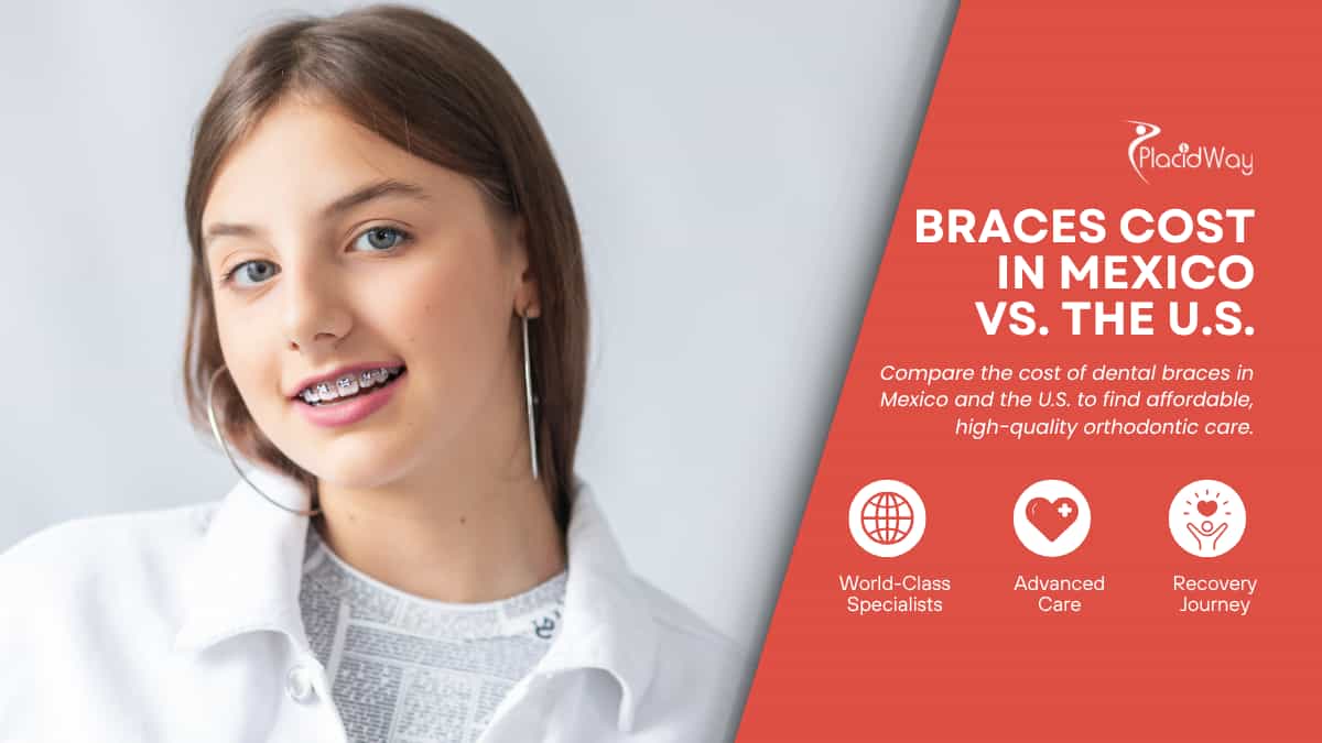 What Is The Cost Of Braces In Mexico Compared To The U.S.?