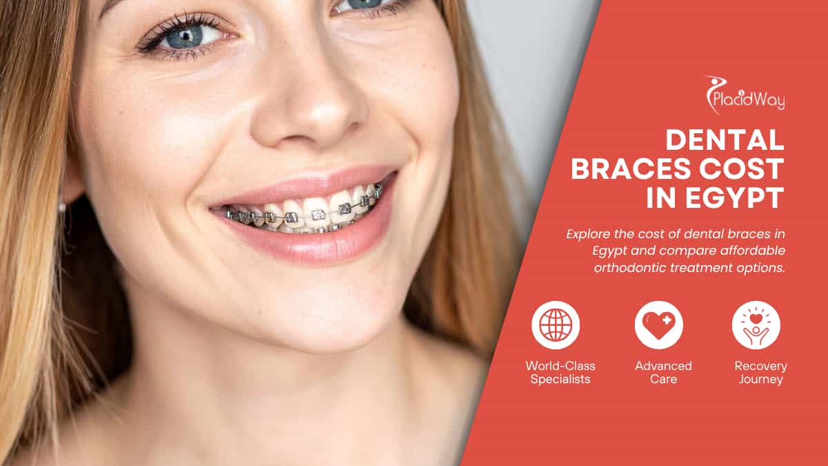 How Much Does Dental Braces Cost in Egypt?