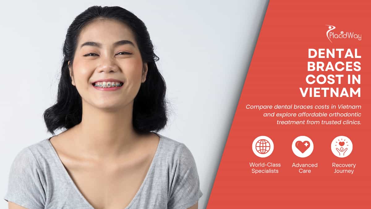 Cost of Braces in Vietnam