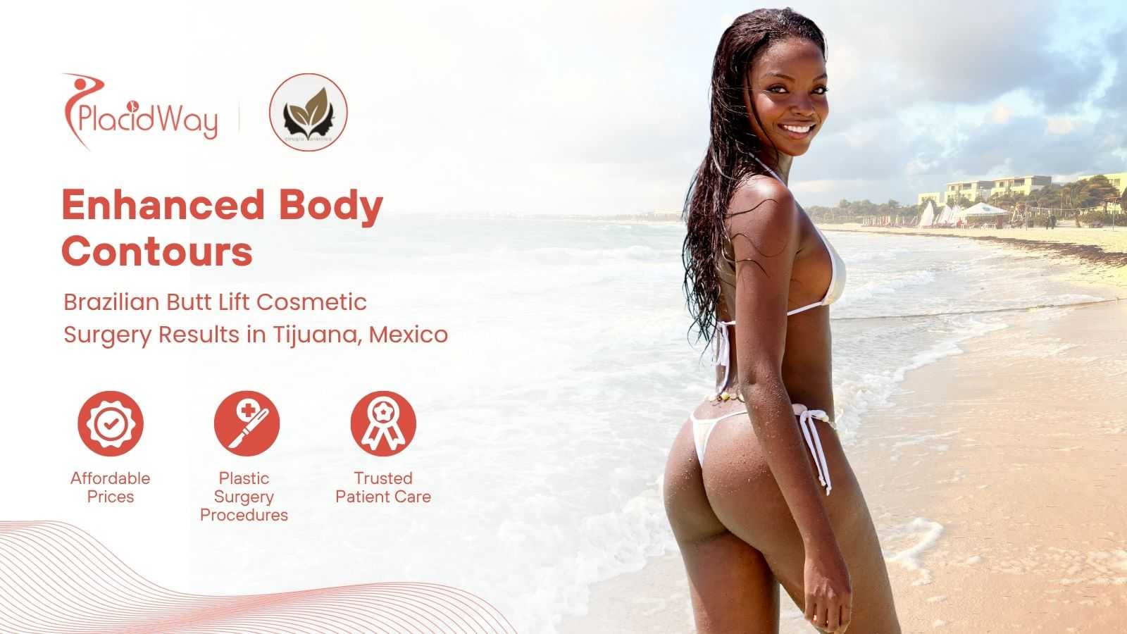 BBL in Tijuana Mexico