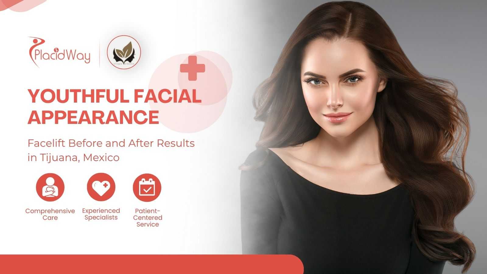 Facelift in Tijuana | Dr. Israel Villalobos