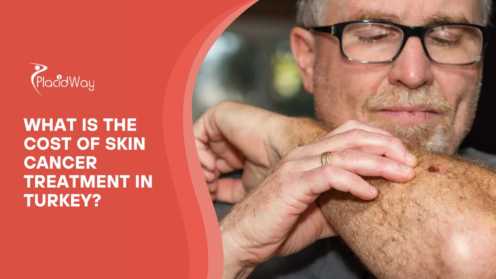 What is the Cost of Skin Cancer Treatment in Turkey?