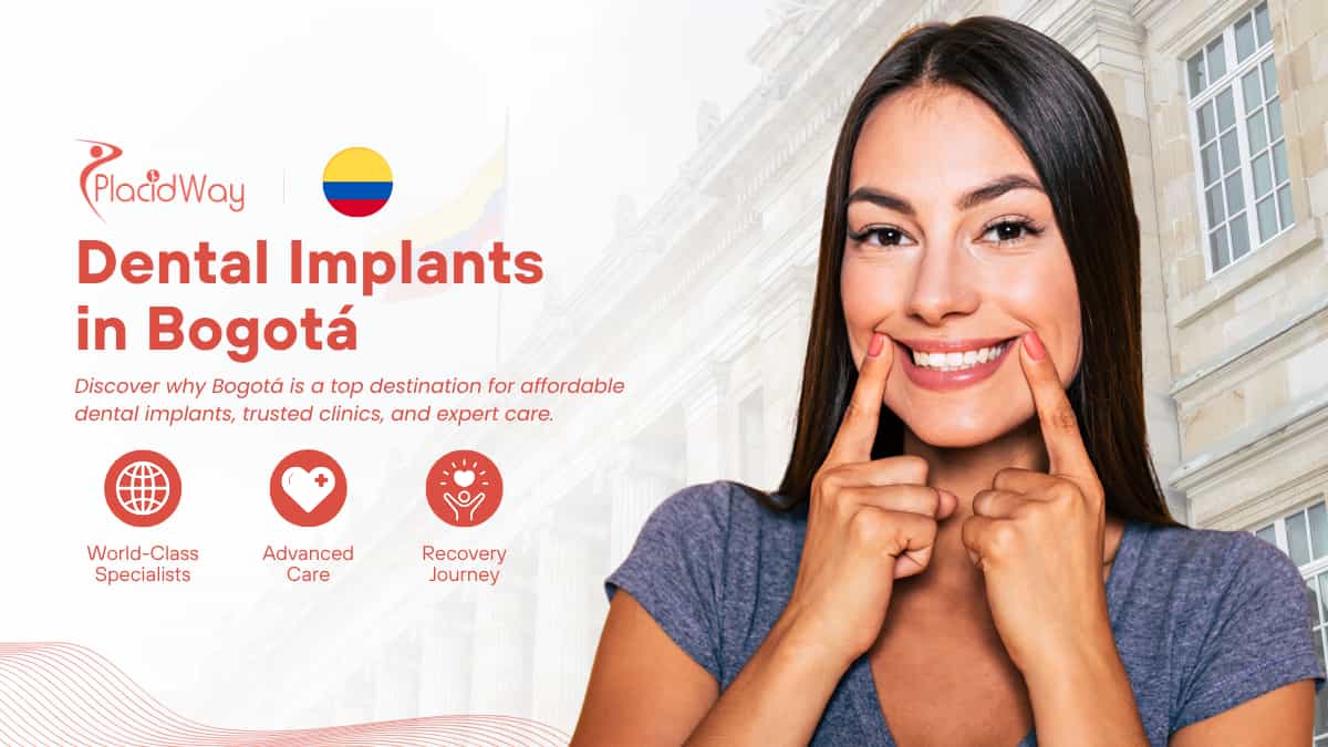 Dental Implants in Bogota, Colombia: Benefits & Why It's the Best Choice