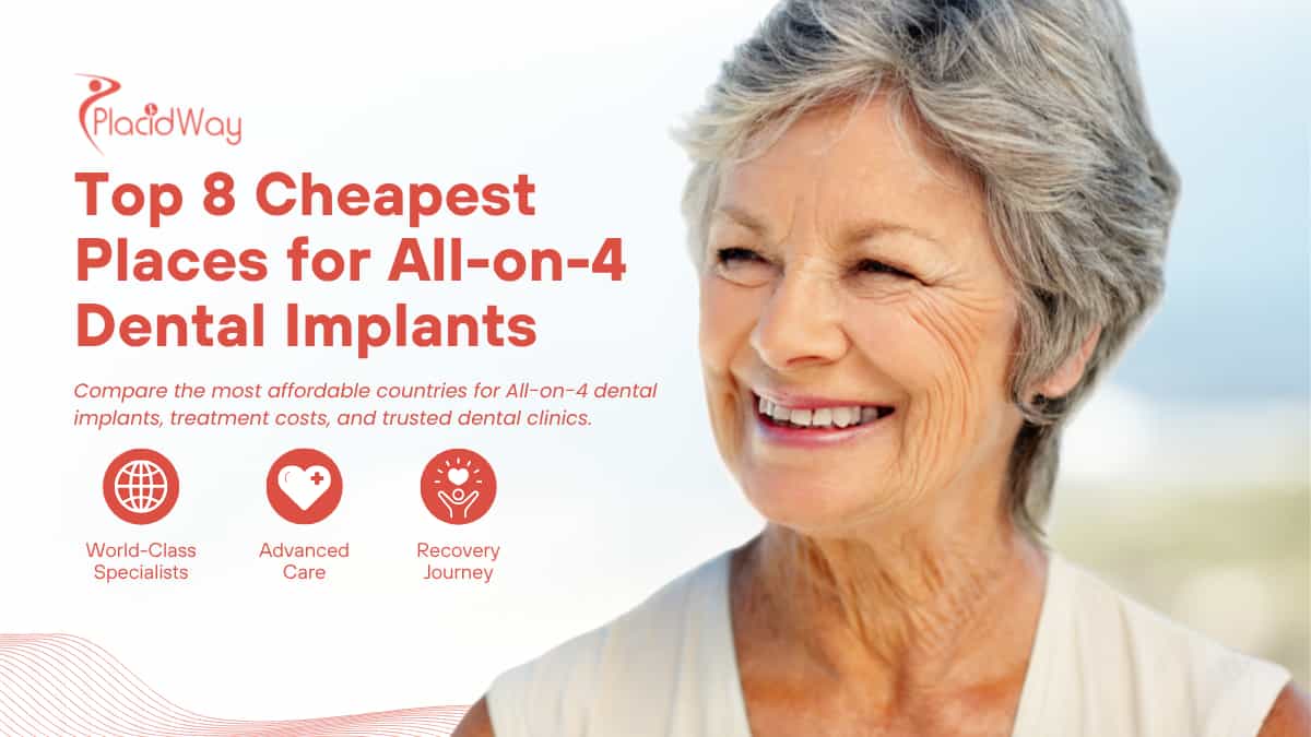 Top 8 Cheapest Places to Get All on 4 Dental Implants
