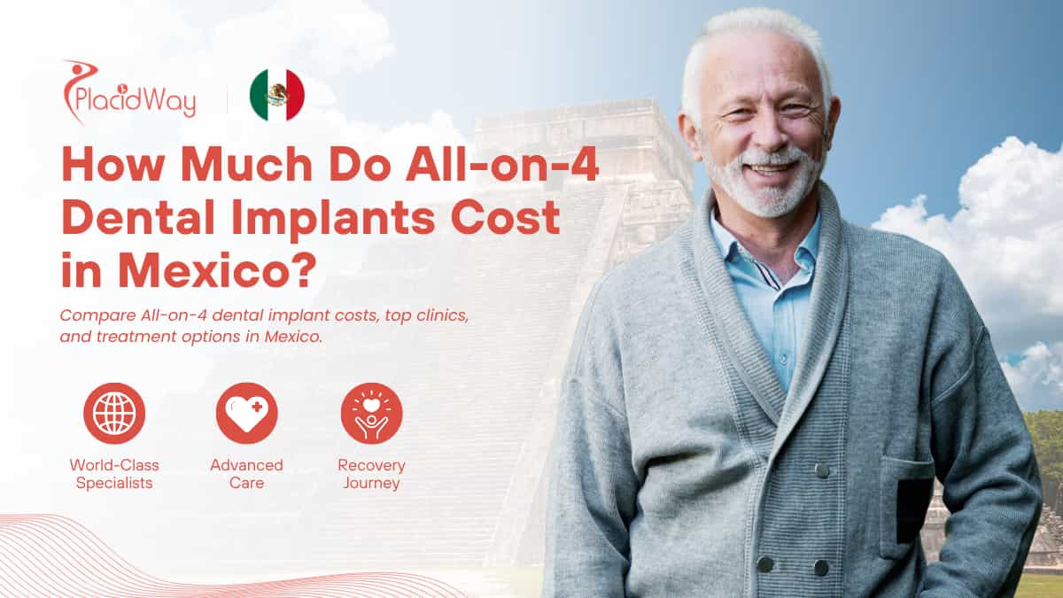 All on 4 Dental Implants Cost in Mexico - Top Clincs & Prices