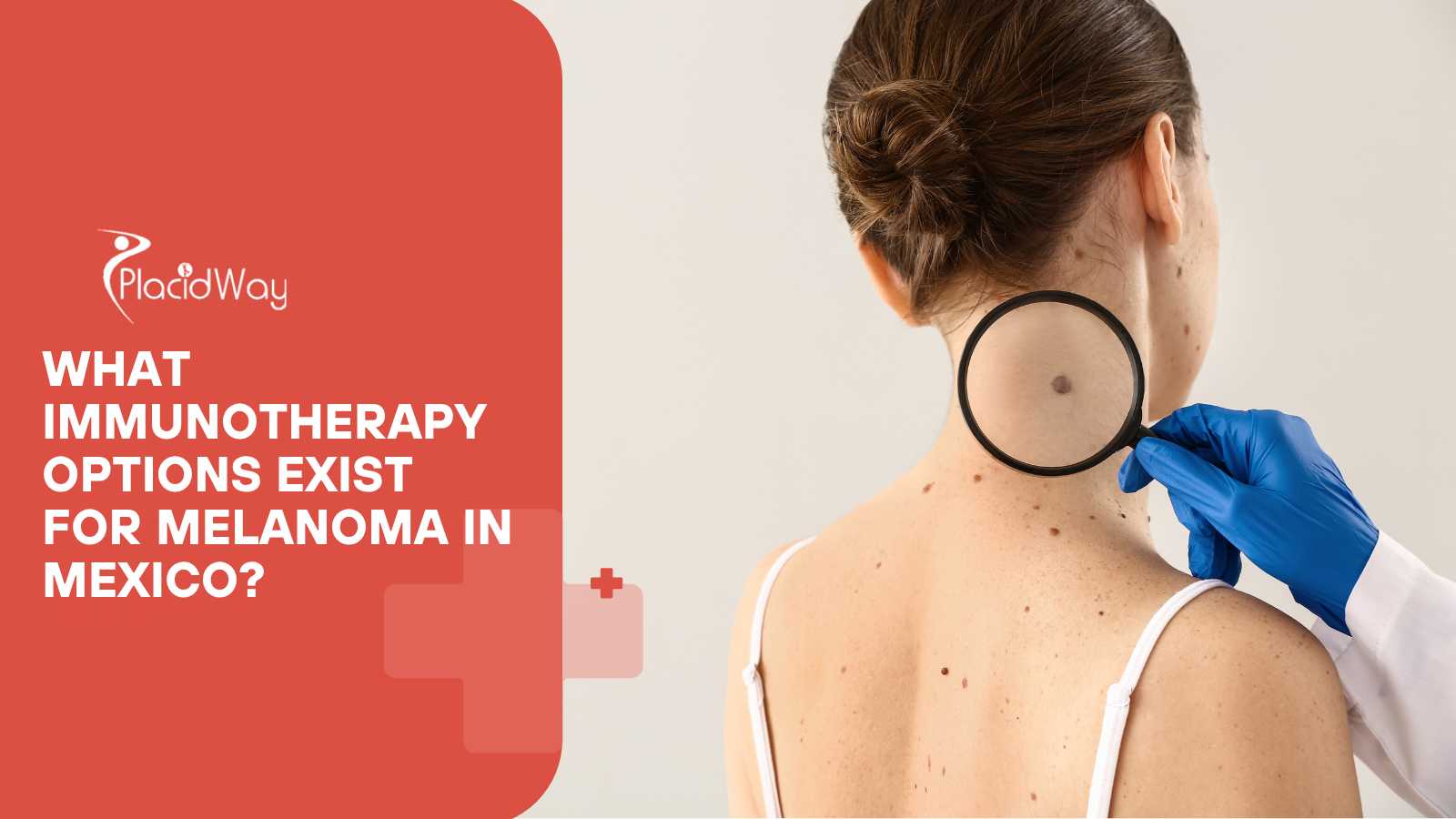 What Immunotherapy Options Exist for Melanoma in Mexico? 