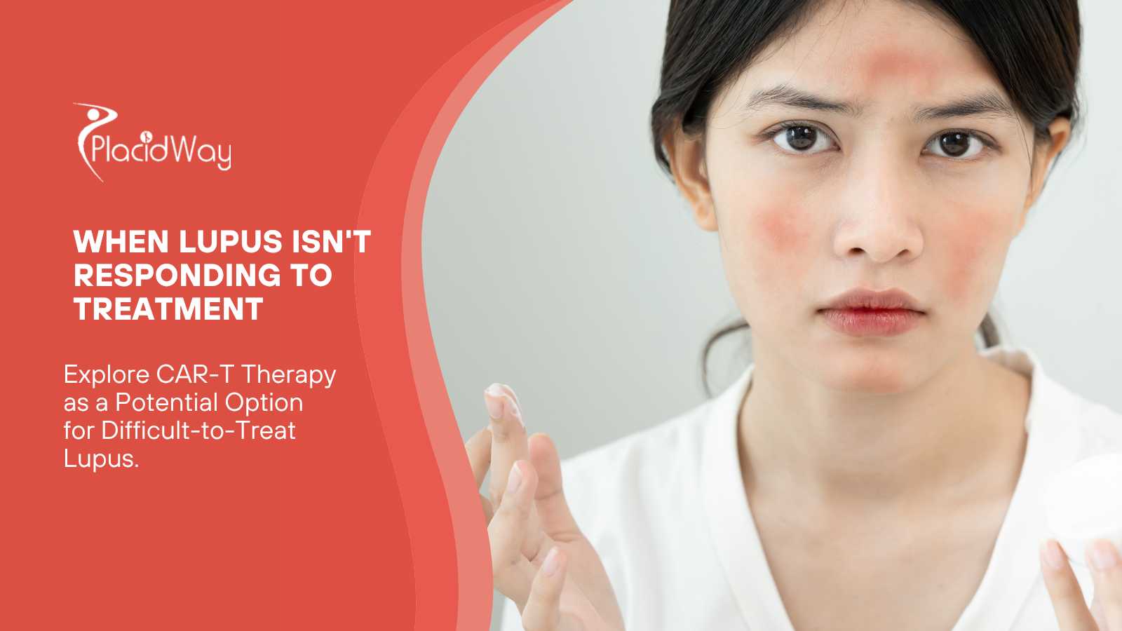 Lupus Not Responding to Treatment—Could CAR-T Be an Option?