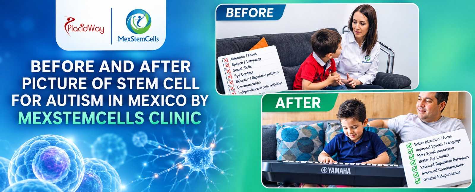 Stem cell therapy patient results at MexStemCells Clinic