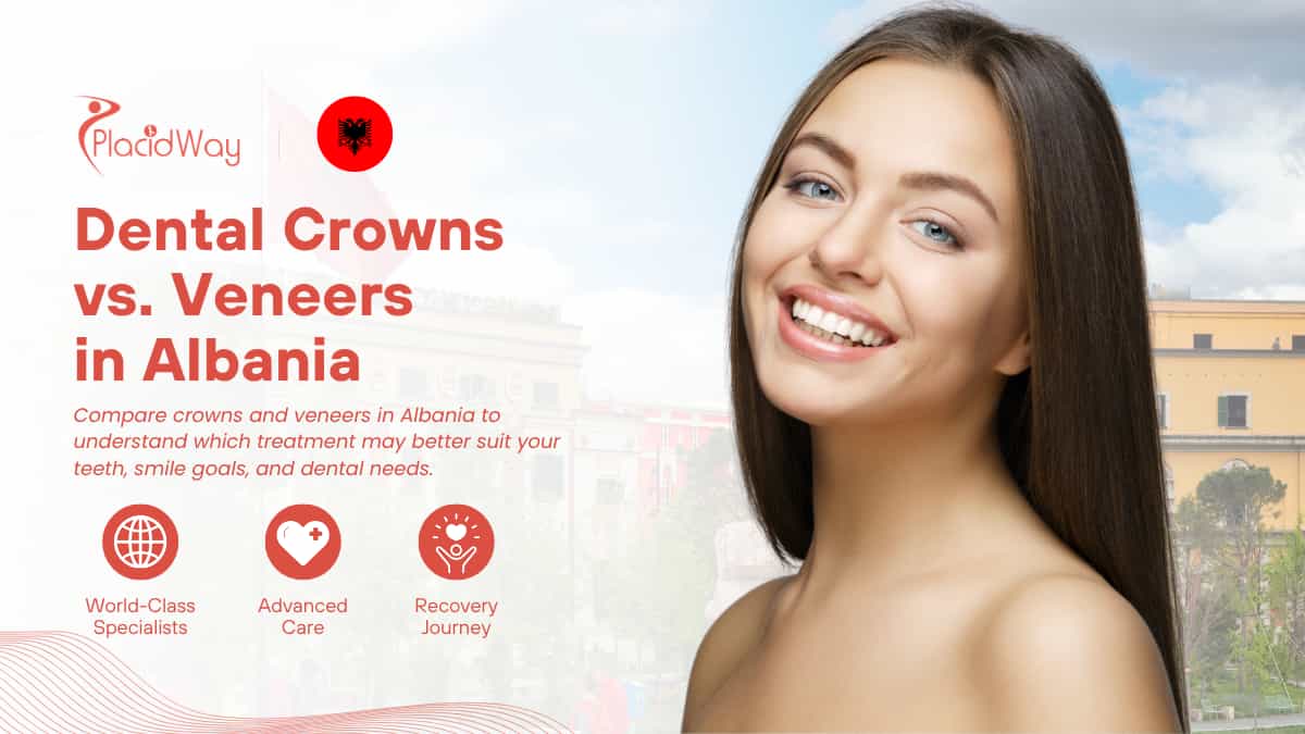 Dental Crowns vs Veneers in Albania: Which Treatment Is Better for Your Smile?