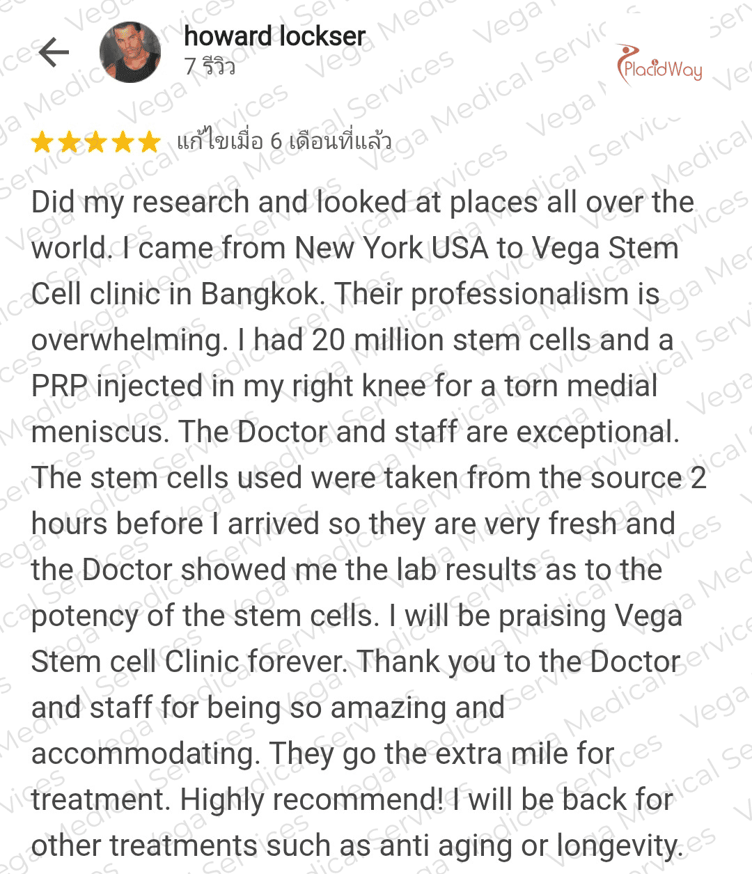 Stem Cells for Osteoarthritis in Bangkok Vega Clinic Joint Mobility