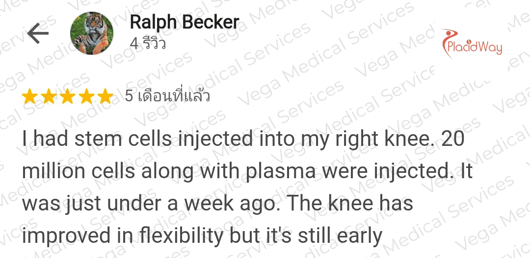 Stem Cells for Knee Osteoarthritis in Bangkok Vega Summary