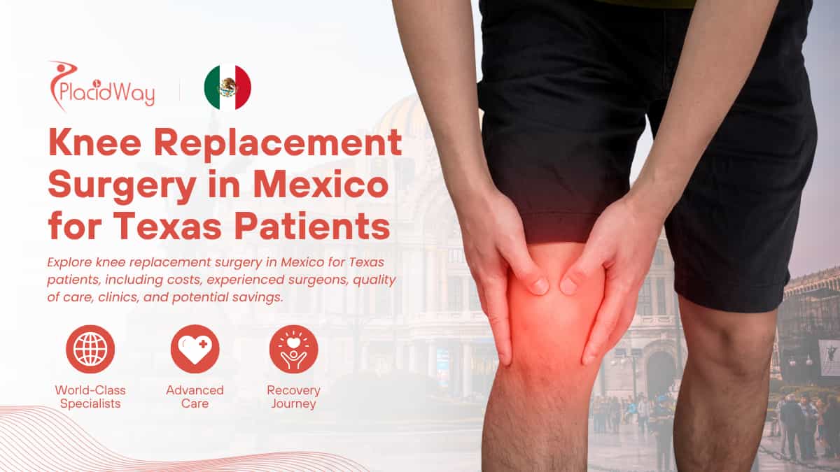 Knee Replacement Surgery in Mexico